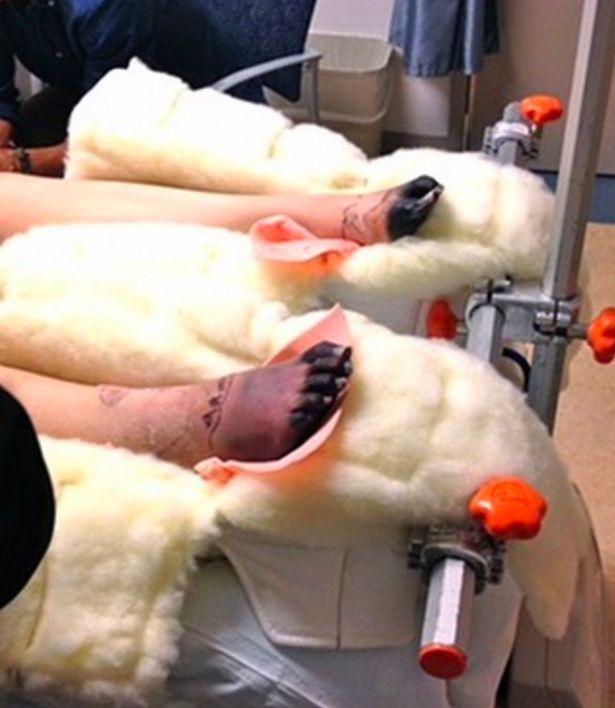 Și-a pierdut piciorul din cauza unui produs pentru igiena intimă. Acum îl va pierde și pe celălalt - IMAGINI ȘOCANTE 498251