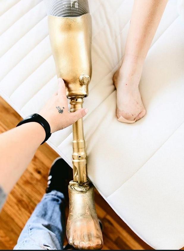  Un celebru fotomodel va rămâne și fără piciorul stâng. Medicii i l-au amputat deja pe dreptul. Ce a pățit tânăra de la un simplu tampon 498794