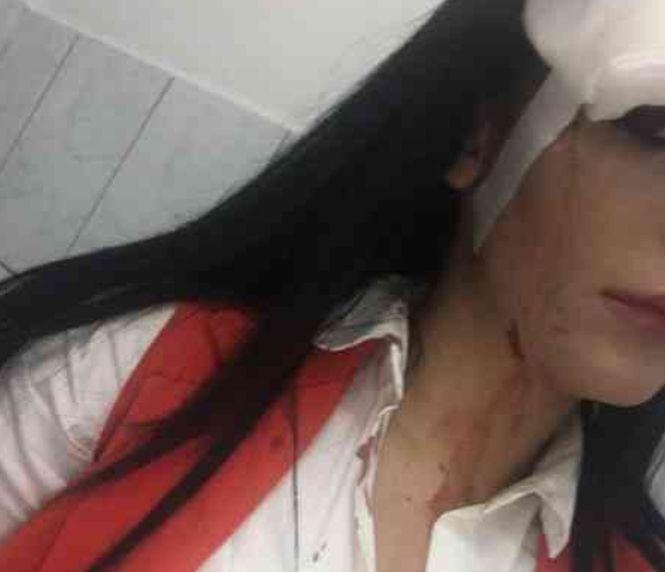 Scene șocante într-un club din Cluj. O cântăreața de muzică populară a ajuns la spital cu capul spart, după ce a fost agresată de cinci luptători MMA 501020