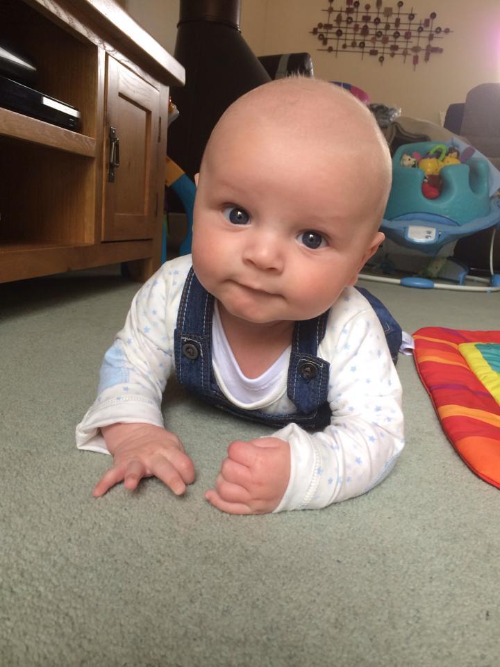 O durea burta atât de tare, că nici nu putea dormi. Salvarea a dus-o la spital, iar după o oră a trăit șocul vieții. Ce au găsit doctorii în burta femeii 501569