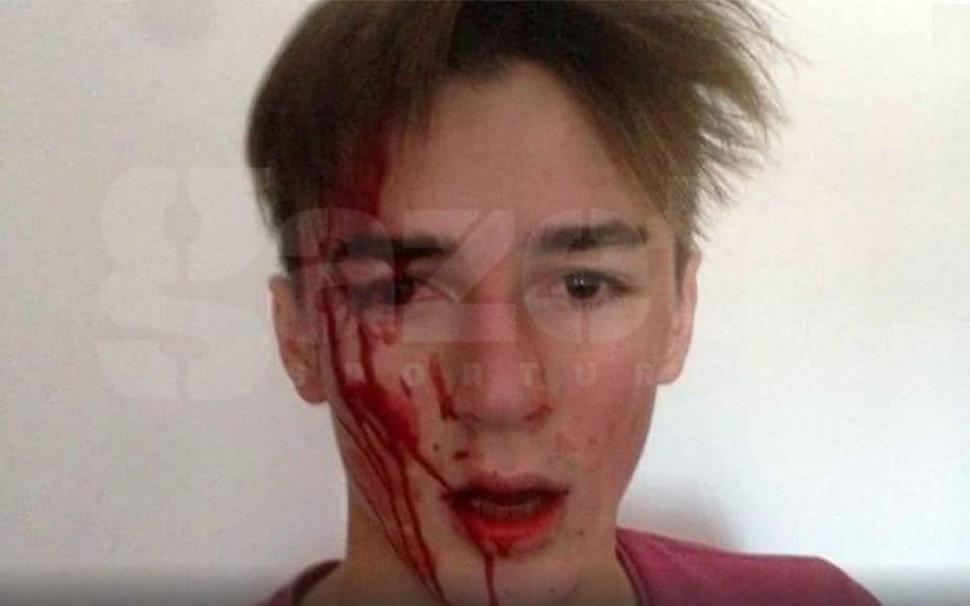 Sportiv român, desfigurat de antrenorul de la lotul național: "M-a luat la pumni și m-a dat cu capul de masă până m-a umplut de sânge!" - FOTO 502219