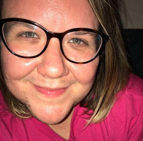 S-a trezit într-o dimineață cu ceva ciudat pe ea și s-a dus de urgență la spital. Medicii i-au spus că nu au ce să-i facă. Acum a decis să le arate tuturor ce i s-a întâmplat și să se accepte așa cum e (FOTO) 510552