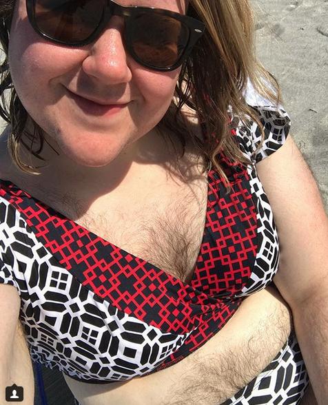 S-a trezit într-o dimineață cu ceva ciudat pe ea și s-a dus de urgență la spital. Medicii i-au spus că nu au ce să-i facă. Acum a decis să le arate tuturor ce i s-a întâmplat și să se accepte așa cum e (FOTO) 510553