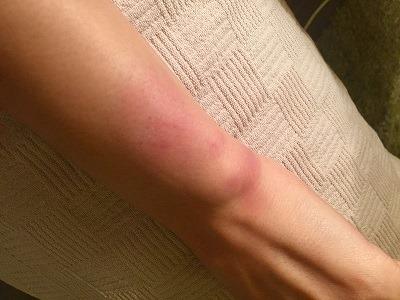 Jurnalistă din TVR, abuzată de fostul partener (FOTO) 511326