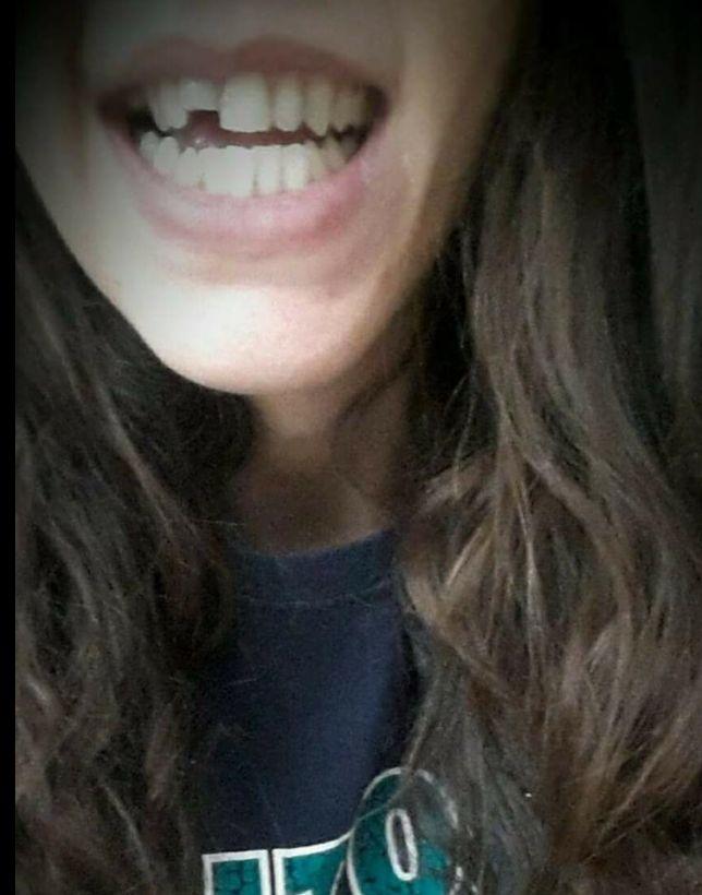 Scandal la un meci de baschet feminin: ”I-au rupt dinții și arbitrii n-au văzut nimic. O să-i dăm în judecată” - FOTO 514176