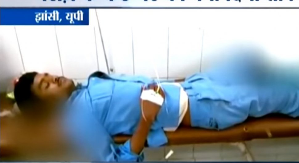 Scene șocante  într-un spital din India. Un pacient doarme cu capul pe piciorul amputat