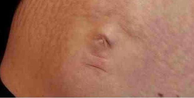 Imaginea incredibilă care i-a apărut pe burtă unei femei însărcinate. A crezut că nu vede bine: „Dumnezeule, așa ceva nu e posibil!” 521776