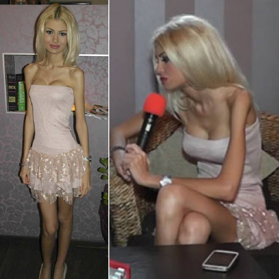 O mai ţii minte pe Flavia? In 2013, era cea mai anorexică femeie! Acum s-a căsătorit! Aşa arată în rochie de mireasă! 