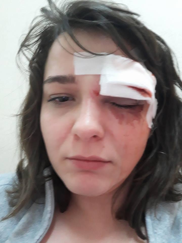 O tânără din Capitală a fost bătută și jefuită chiar în apropierea casei. Totul a durat câteva minute 525131