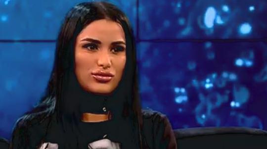 Apariție șocantă la TV! Daniela Crudu, distrusă de operațiile estetice 529216