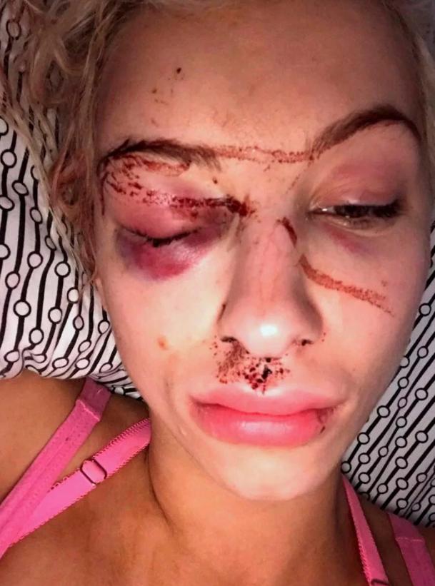 A fost bătută cu sălbăticie timp de 21 de ore. Cum a scăpat acest fotomodel de furia prietenului, cu ajutorul unui selfie 530792