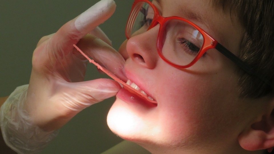 Proiect inedit: Primăria Capitalei ar putea să ofere bani copiilor care au nevoie de aparat dentar