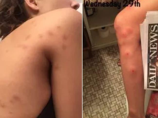 Un model Victoria’s Secret dă în judecată un hotel de lux. Este cumplit ce i s-a întâmplat frumoasei într-o singură noapte (FOTO) 550940