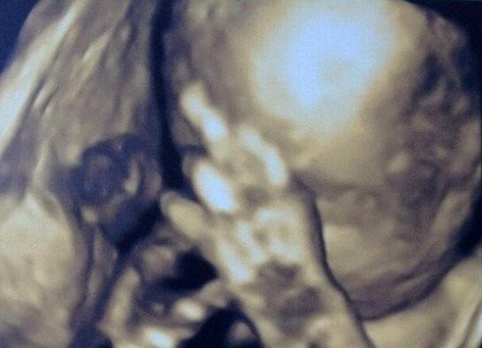 "Nu mă mai fotografia!" Gestul obscen pe care un făt l-a făcut în pântecele mamei, în timpul ecografiei - FOTO 553888