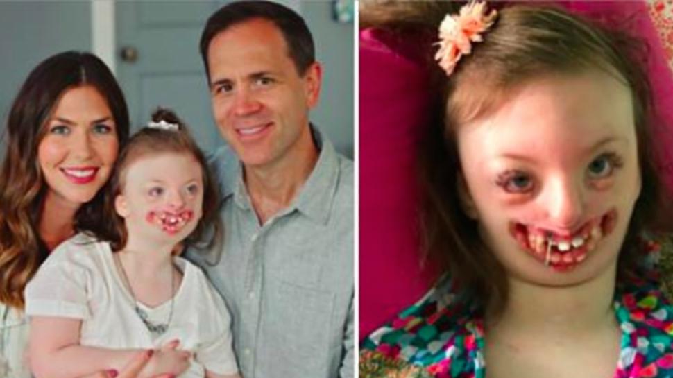 A aflat că o fotografie cu fiica ei era folosită pentru a promova avorturile. Mesajul femeii este de-a dreptul emoționant. „Mulți dintre ei nu contează” 556362