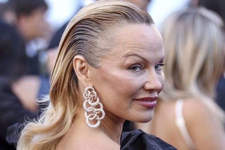 Pamela Anderson a ajuns în cârje la 51 de ani! Ce s-a întâmplat cu una dintre cele mai sexy femei din lume?