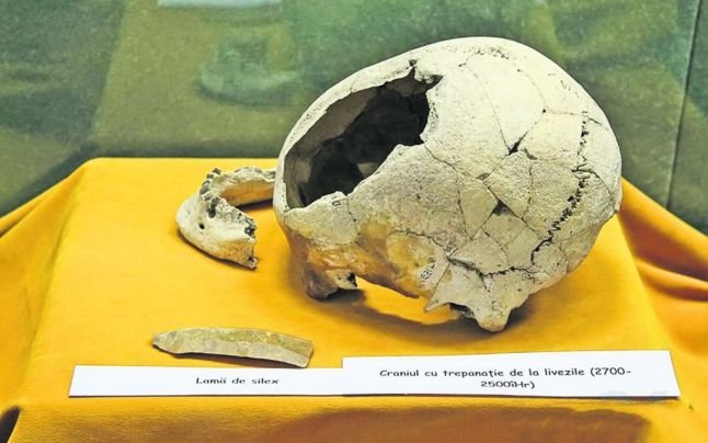 Descoperire arheologică majoră, în România. Operație pe creier făcută cu succes în urmă cu 4.500 de ani 