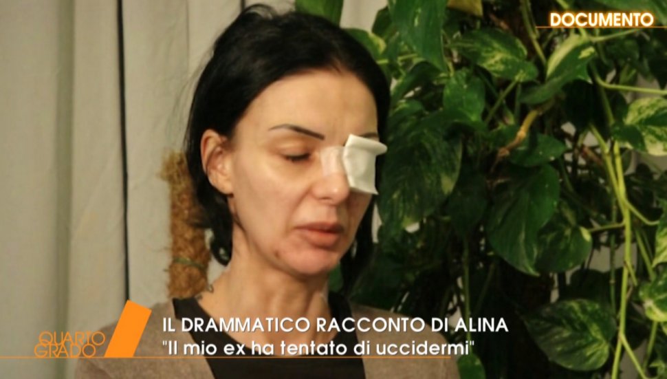  Mărturia sfâșietoare a Alinei, românca atacată cu acid în Italia: "Am crezut că o să mor. În acele momente cumplit nu m-am gândit decât la fiul meu”
