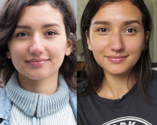 A fost vegetariană patru ani. A avut un șoc după ce a reintrodus carnea în dieta ei. „Așa arată fața mea acum. Incredibil!” 566556