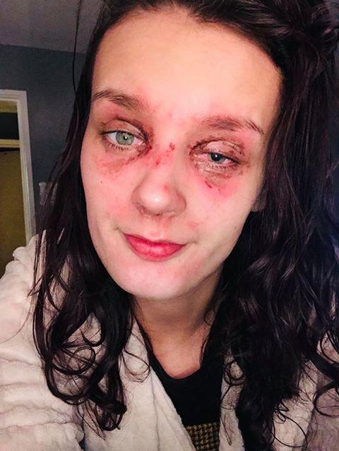 A intrat în bucătărie să își prepare micul dejun, dar ce a urmat s-a transformat într-un coșmar pentru tânără. Toată lumea face asta (FOTO) 569828