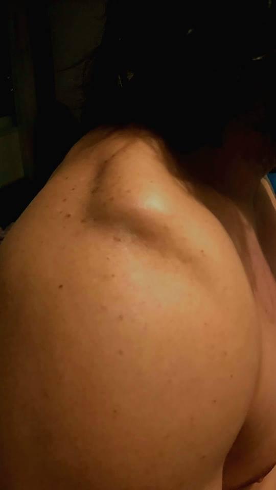 Vacanța lui Pepe s-a transformat într-un coșmar. Artistul a suferit un accident pe o pârtie din Brașov 570597