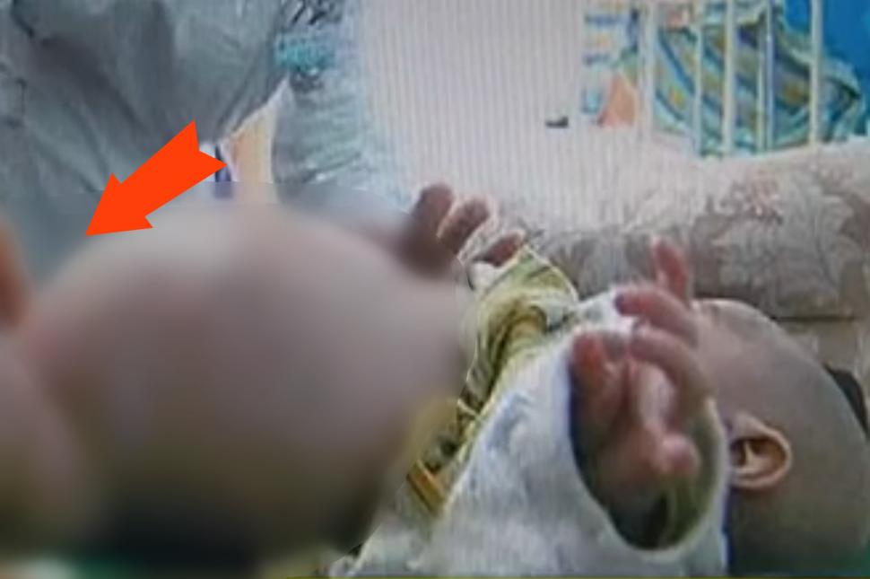 Părinții au ajuns la spital urlând cu copilul a cărui burtă se umflase brusc și era uriașă. Medicii s-au blocat: "Trebuie să vă spunem ceva îngrozitor: Îi trebuie cezariană!" Ce avea copilul în el 571067