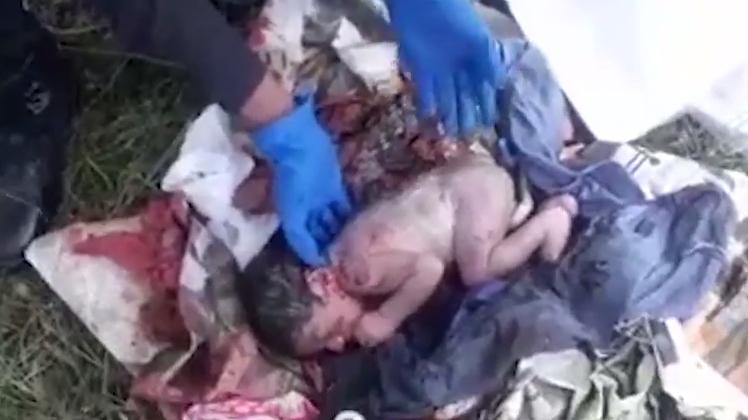 Gunoierii veniseră să ridice tomberoanele, când au auzit un zgomot dintr-un sac. S-au apropiat să se uite mai bine și au împietrit. Era acolo și mișca (FOTO) 573596