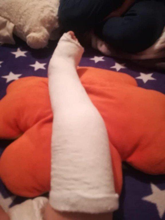 Alina s-a dus cu copilul ei la spital, unde i s-a făcut o radiografie și apoi trimis acasă. Femeia i-a dat nurofen după nurofen și a revenit cu micuțul la spital. Degeaba. Când a ajuns la București, medicii au încremenit: Cum de a putut fi lăsat așa? 579219