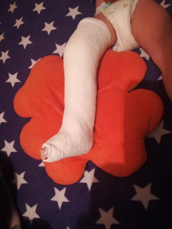 Alina s-a dus cu copilul ei la spital, unde i s-a făcut o radiografie și apoi trimis acasă. Femeia i-a dat nurofen după nurofen și a revenit cu micuțul la spital. Degeaba. Când a ajuns la București, medicii au încremenit: Cum de a putut fi lăsat așa? 579220