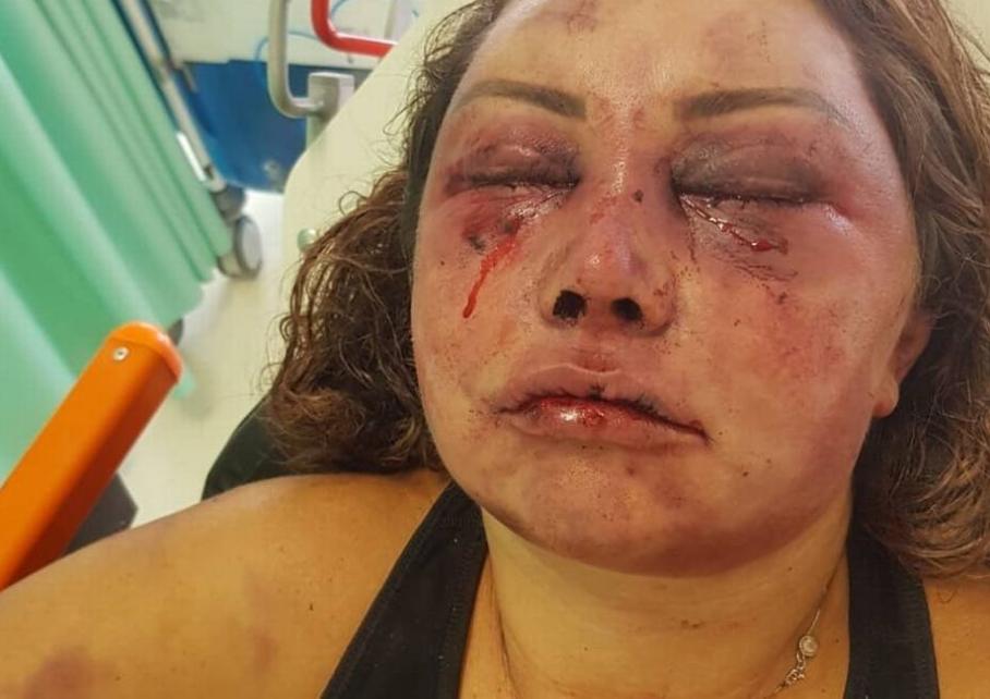 Au vorbit timp de opt luni pe o rețea de socializare când au decis în sfârșit să se cunoască în realitate. Femeia l-a invitat pe tânăr la ea acasă. Timp de patru ore a trăit însă un coșmar: „Efectiv, nu s-a mai oprit” (FOTO) 579250