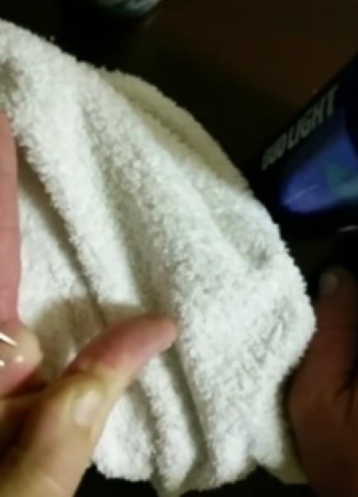 Prietenul lor dormea, iar ei i-au spart chistul de pe mână! S-au crucit când au văzut ce a ieșit de acolo - FOTO 580291