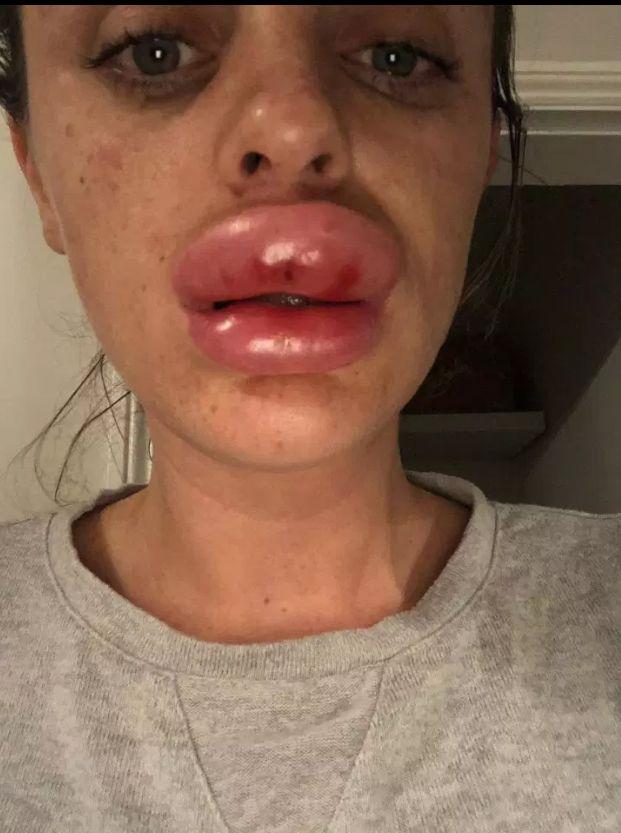 A vrut să își facă o schimbare, însă, la scurt timp totul s-a transformat într-un coșmar. Prețul frumuseții pentru o tânără (FOTO) 589891