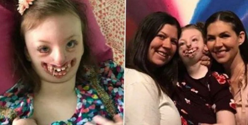Sophia, fetița desfigurată de boala Rett și pe care unii „internauți” au batjocorit-o, a murit la vârsta de 10 ani