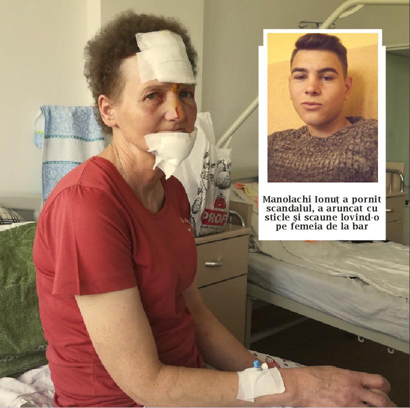 Lenuța este barmaniță la discoteca dintr-un sat din Vaslui. A dat de băut la toată lumea și pe la ora trei a început calvarul. Femeia s-a trezit cu pumni și scaune în cap. E ireal cum arată acum - FOTO 596258