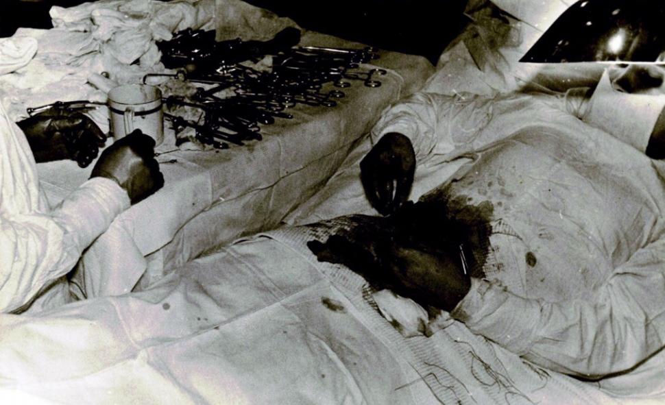 Povestea doctorului care s-a operat singur de apendicită. Ce a urmat, este ireal: „Am simțit că-mi stă inima” - FOTO 599659