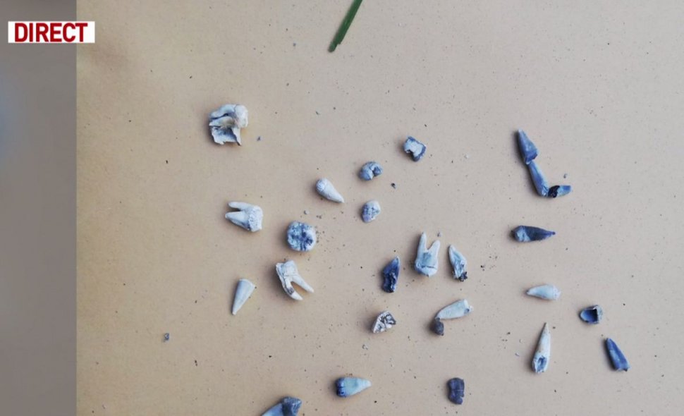 Așa arată resturile de oase și dinții pe care le-au găsit polițiștii în curtea suspectului în cazul Alexandrei