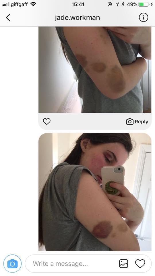 A început să iasă cu colegul său, dar nu s-a așteptat nicio clipă la ce coșmar avea să trăiască alături de el. La doar o lună, tânăra de 18 ani nu știa cum să scape de el. Apoi, bărbatul i-a zis ceva de-a dreptul cutremurător (FOTO) 609678