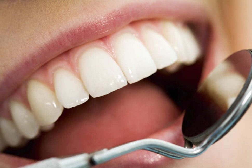 Românii ar putea da bani mai puţini pe dentist. CNAS vrea să dubleze plafonul de decontare a serviciilor stomatologice