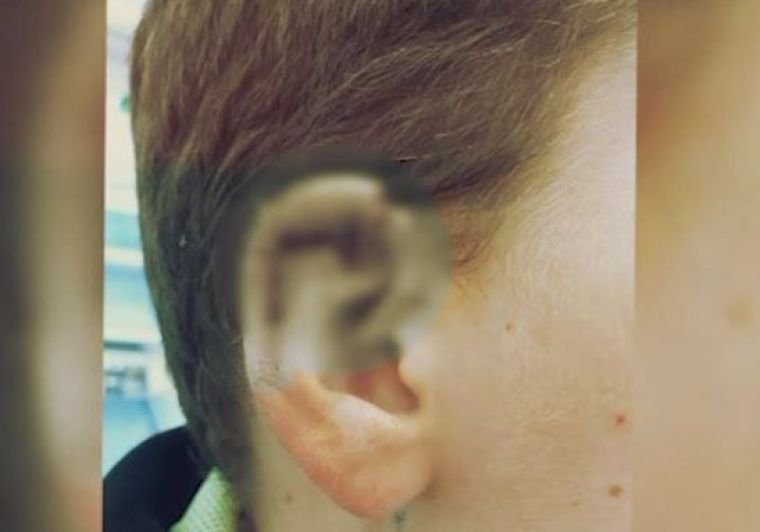Incident grav la o școală din București! Un băiețel a căzut și și-a secționat urechea, însă nimeni nu a chemat Salvarea