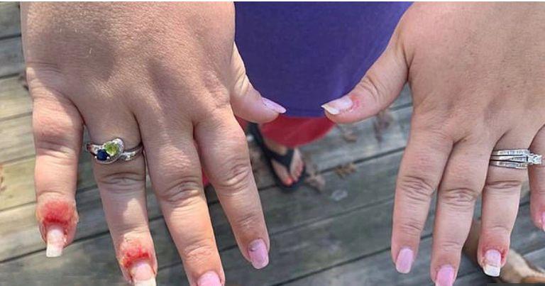 A vrut o manichiură de vis, dar s-a ales cu un coșmar: degete umflate și pline de puroi. Cum arată acum unghiile femeii. IMAGINI șocante! 627021
