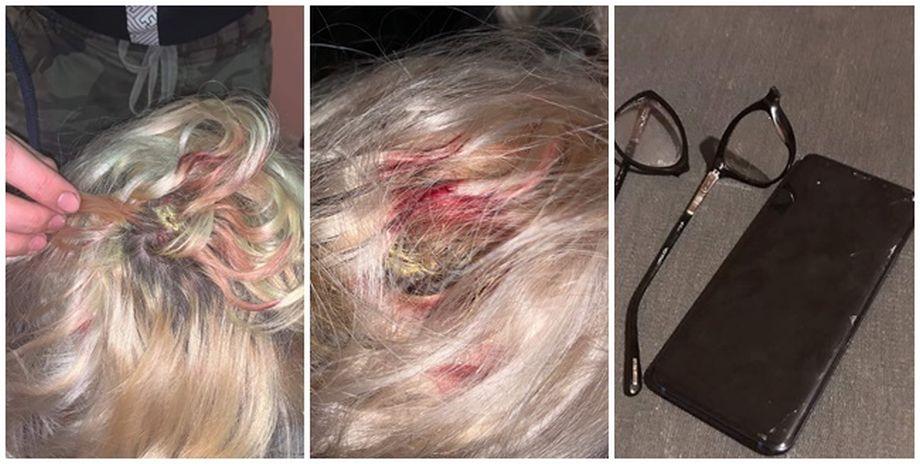 Lovitură pentru USR. Șefa filialei Găvojdia, acuzată că a lovit o tânără și ar fi furat un dres de baie și o pereche de șlapi 637401