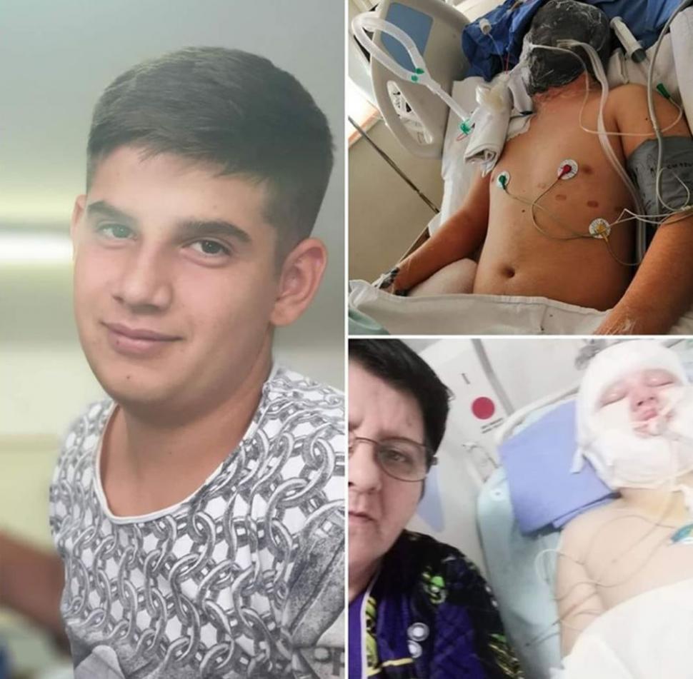 La 17 ani, Robert muncea pentru a-și ajuta familia numeroasă. După ore, adolescentul se ducea la un service auto pentru a munci. Într-o zi, la locul de muncă a avut o explozie... 640338