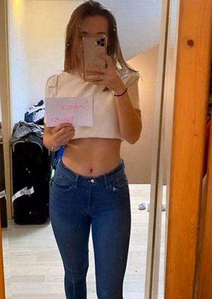 Are 20 de ani și a fost rănită într-un accident rutier. Fata a decis să renunțe la ce are mai de preț, pentru a-și plăti facturile la spital  644825