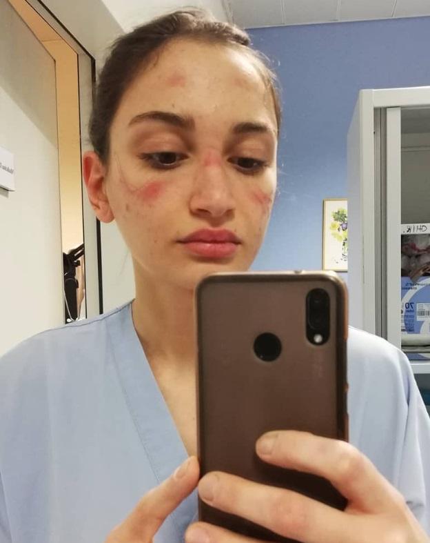 Mesajul zdrobitor al unei asistente medicale din Italia: ”Sunt obosită fizic, nu mai pot merge la baie. Nu îmi permit luxul de a merge înapoi la casa mea” 651236