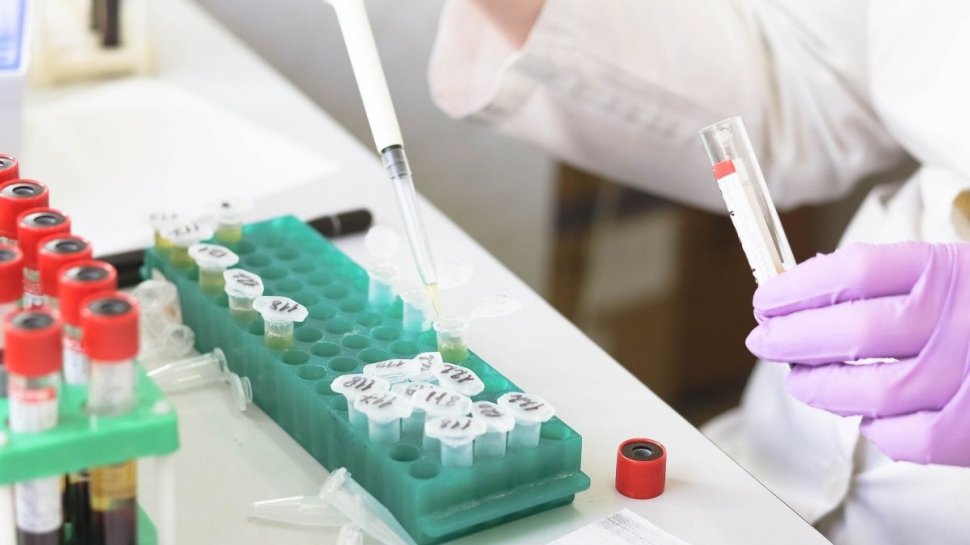 Unifarm, despre testele pentru coronavirus: Compania a achiziționat 200.000 teste