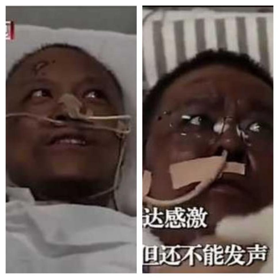 Doi medici chinezi infectați cu coronavirus s-au trezit din comă total schimbați. Le-a fost greu să se recunoască în oglindă (FOTO) 657781