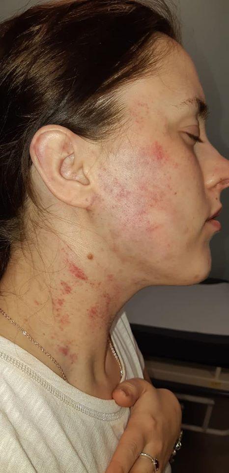 Fusese domnișoară de onoare la nunta surorii sale, dar când a ajuns acasă a început coșmarul pentru ea: „Totul a durat o oră și jumătate” (FOTO) 665918