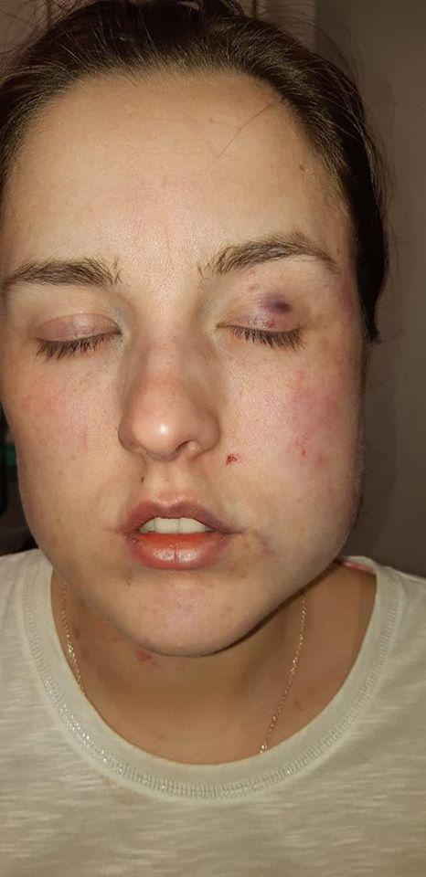 Fusese domnișoară de onoare la nunta surorii sale, dar când a ajuns acasă a început coșmarul pentru ea: „Totul a durat o oră și jumătate” (FOTO) 665921