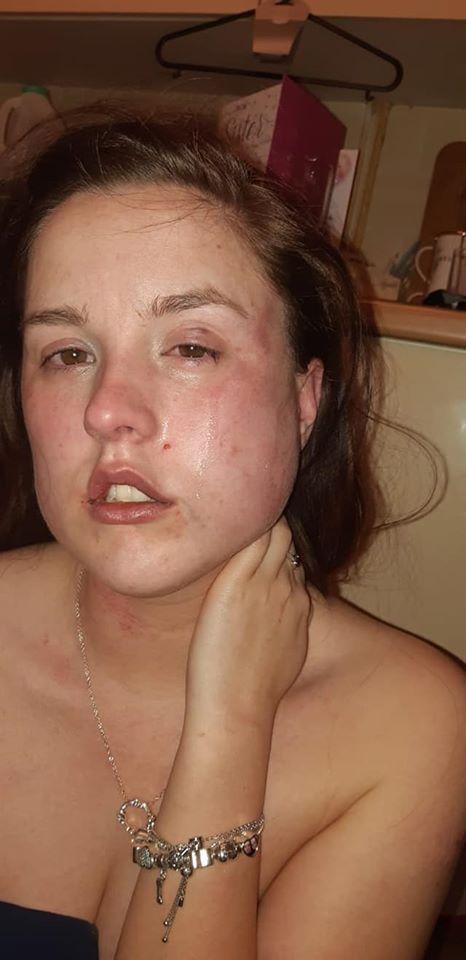 Fusese domnișoară de onoare la nunta surorii sale, dar când a ajuns acasă a început coșmarul pentru ea: „Totul a durat o oră și jumătate” (FOTO) 665923