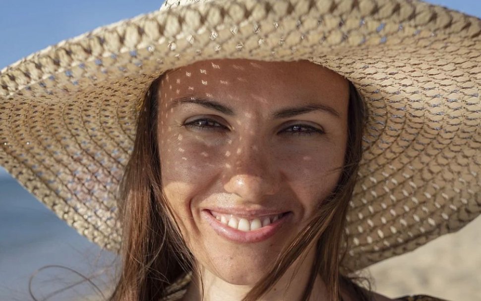 Dr. Olga Simionescu, semnal de alarmă asupra expunerii la soare: 'Se poate muri dintr-o aluniţă mult mai rău decât dintr-o tumoră la stomac'